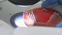 Bacteria studied under a microscope for antibiotic resistant strains
