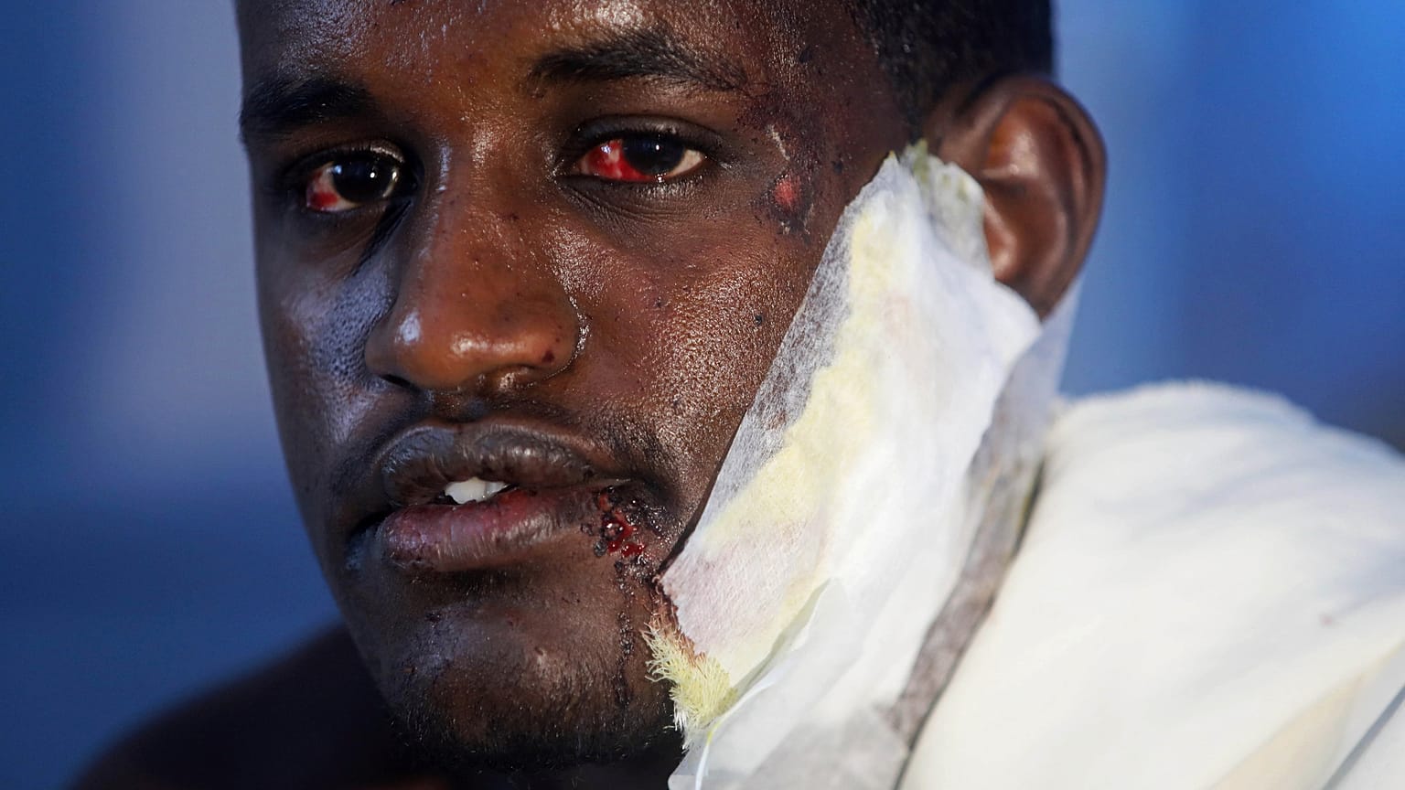 Mogadiscio : le bilan de l'attentat islamiste revu à la hausse