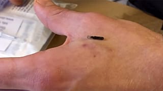 Çalışanlara takılan mikroçipler İngiltere'de tartışma konusu