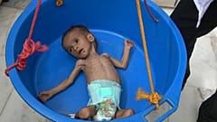 باختصار.. هذا هو حال اليمن اليوم