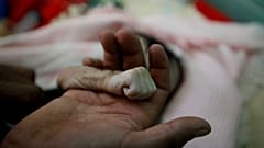 Yemen'de açlıktan dolayı ölen 4 aylık bebek
