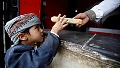 روز جهانی کودک؛ ۲۰۰ هزار کودک یمنی سوءتغذیه دارند