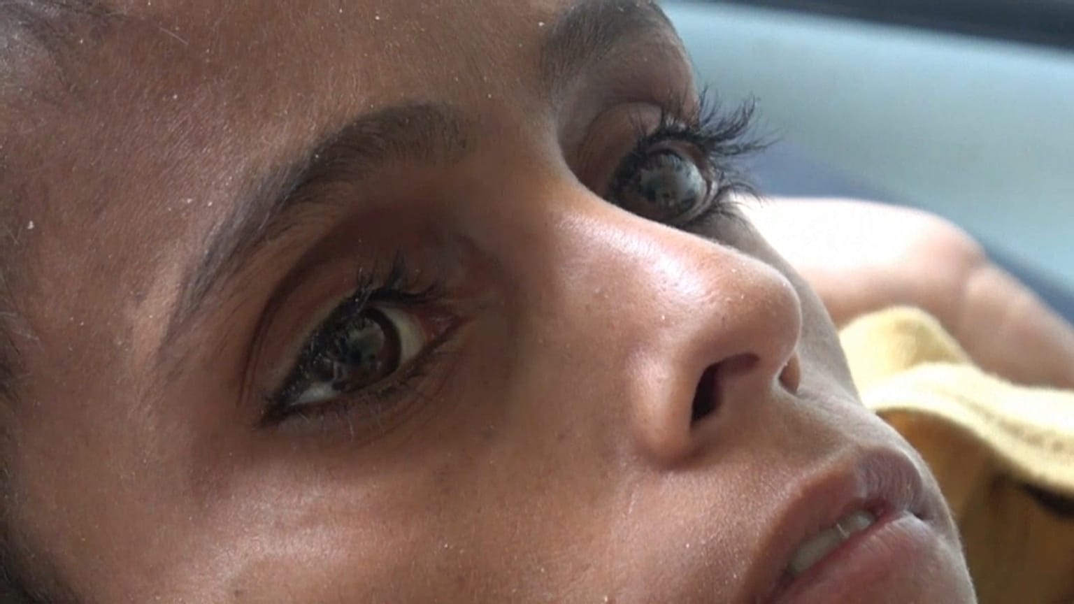 Ghazi, enfant famélique du Yémen, 10 ans, 8 kilos 