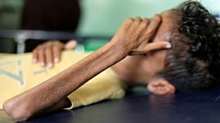 کودک ۱۰ ساله یمنی که به دلیل جنگ و قحطی تنها ۸ کیلوگرم وزن دارد