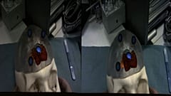 Augmented Reality to Change Surgery Techniques