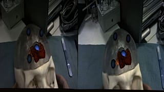 Augmented Reality to Change Surgery Techniques