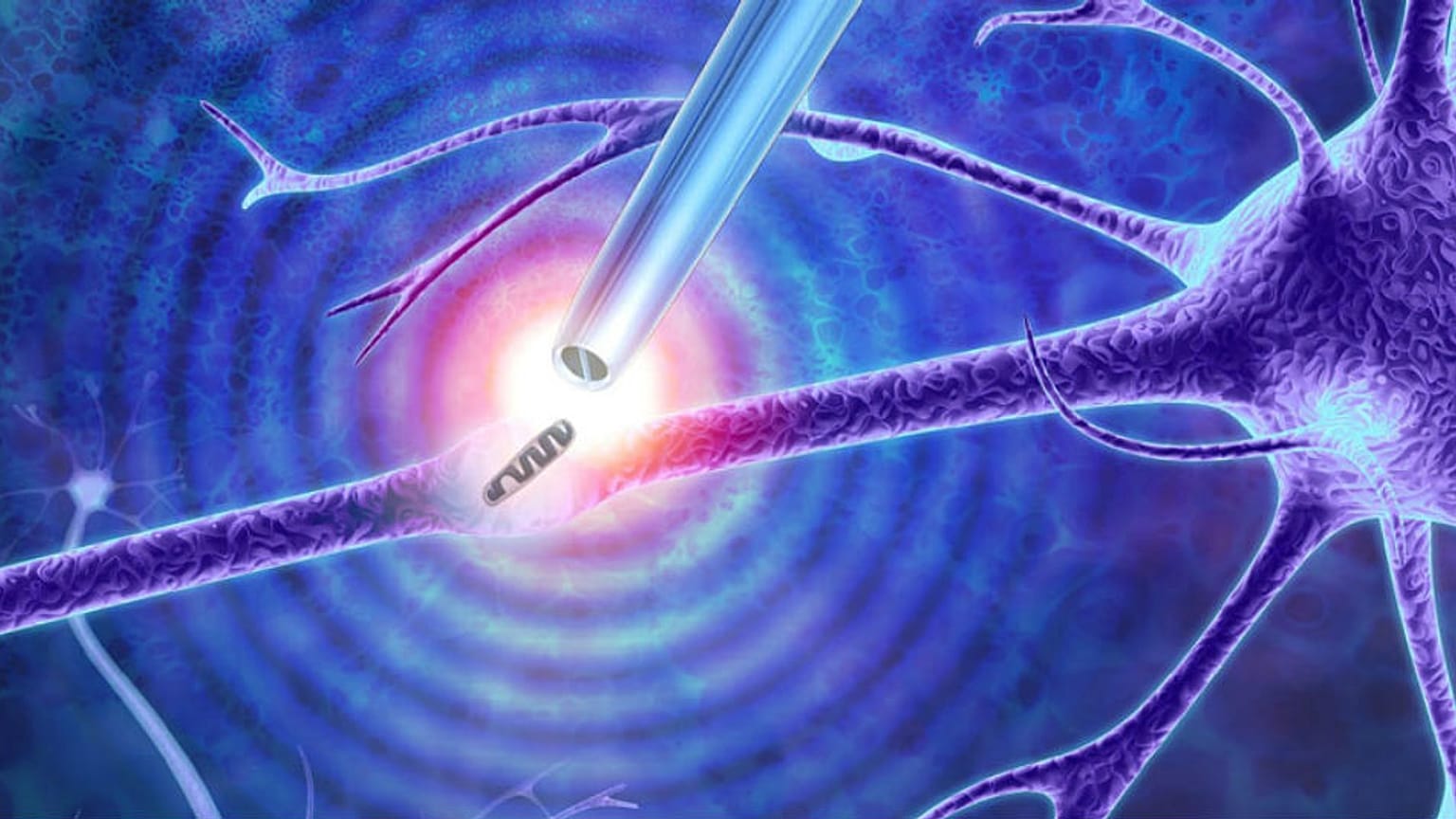 Tıpta yeni keşiflerin kapısını açacak olan alet: Nano-cımbız