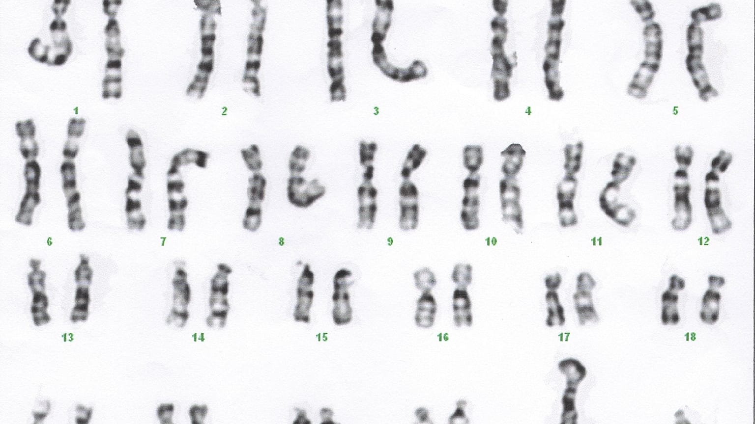 Karyotype 