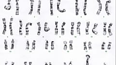 Karyotype 