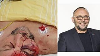 Imagen de las heridas de Magnitz recortada.