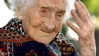 Alzheimer tedavisinde yeni umut: Gelişimi ilk belirtiler görülmeden yıllar önce izlenebilecek