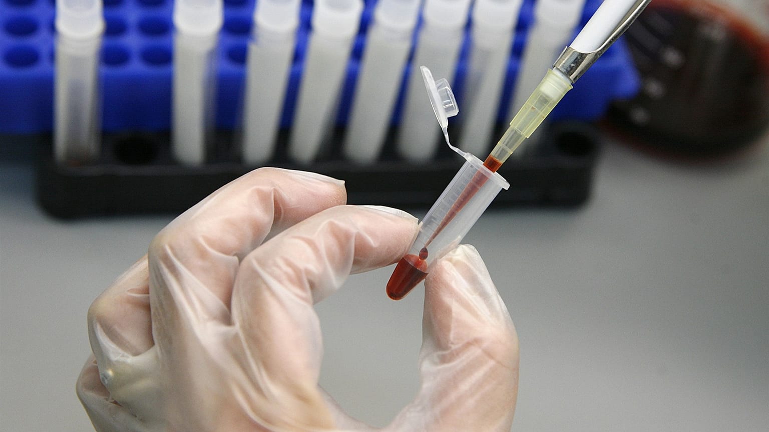 Singapur'da HIV taşıyan 14 bin 200 kişinin özel bilgileri internete sızdırıldı