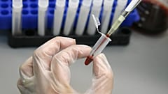 Singapur'da HIV taşıyan 14 bin 200 kişinin özel bilgileri internete sızdırıldı