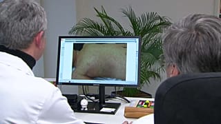 13 Fälle bestätigt: Grazer Kinderambulanz kämpft gegen Masernausbruch