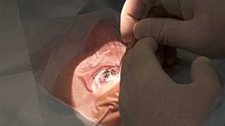 Video: Bilim insanları biyolojik robotlar yardımıyla kendi kendine şekil alan yapay kornea üretti