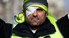 دوازدهمین خیزش جلیقه‌زردها برای حمایت از مجروحان چند مجروح بر جای گذاشت