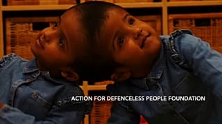 Coopération médicale pour séparer des siamoises du Bangladesh