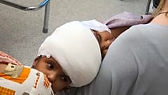 Macar doktorlar başı yapışık ikiz bebeklerin ameliyatını başarıyla tamamladı