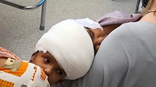 Macar doktorlar başı yapışık ikiz bebeklerin ameliyatını başarıyla tamamladı