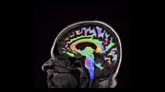 'I was not who I was' - Research into new care for traumatic brain injury victims
