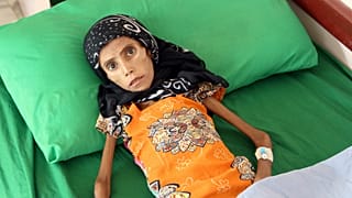 بحران انسانی در یمن؛ دختر ۱۲ ساله با ۱۰ کیلو وزن بستری شد