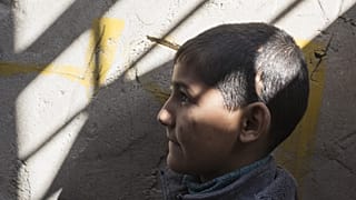A child in Iraq who was struck in the head with shrapnel