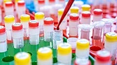 German hospital apologises for 'false hope' over new 'non-invasive' breast cancer blood test