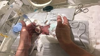 Γεννήθηκε με βάρος μόλις 268 γραμμάρια και κατόρθωσε να επιζήσει!!!