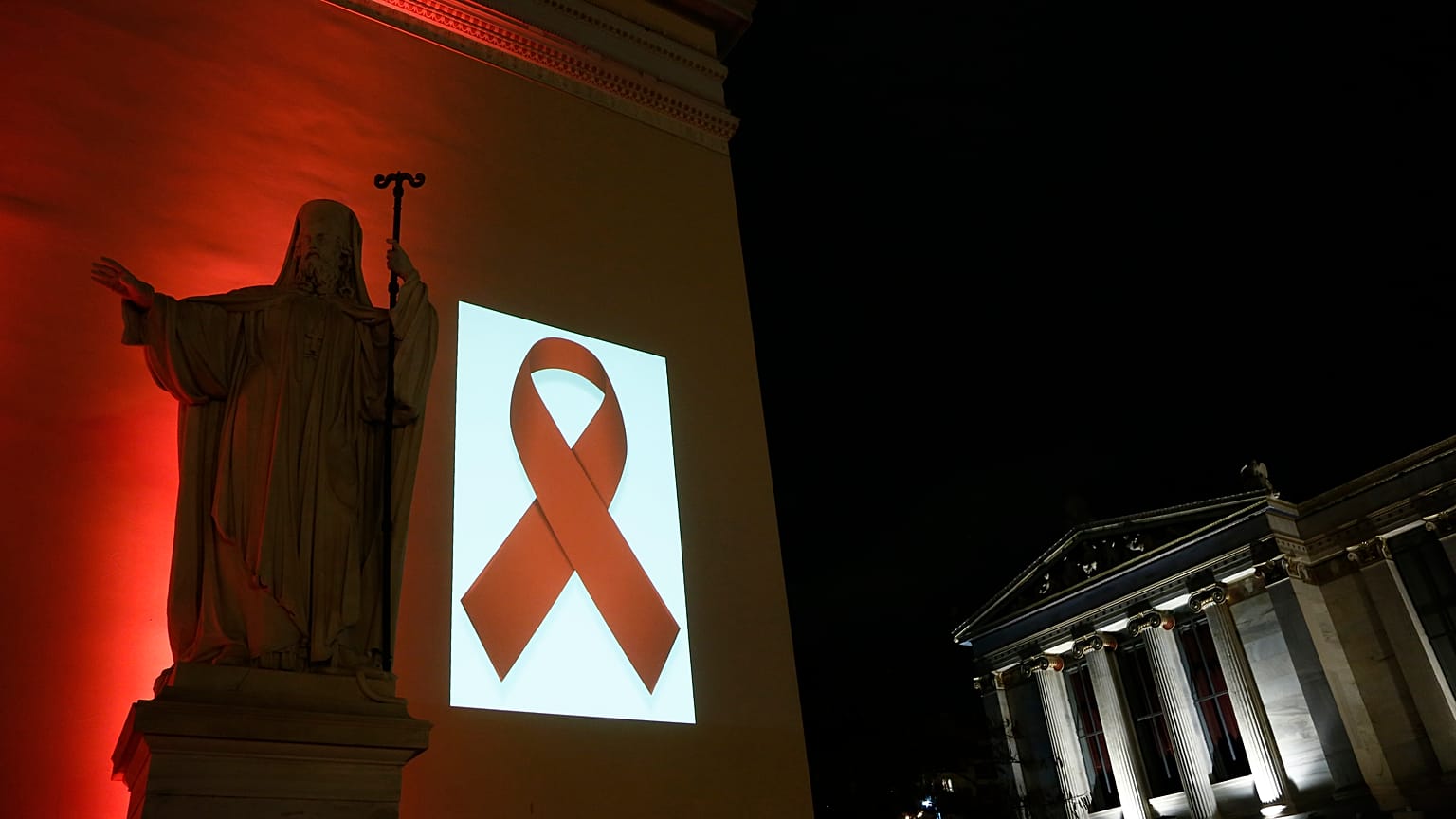 Θεραπεύτηκε ασθενής με AIDS