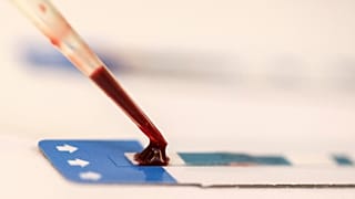 Médicos apontam para cura de segundo paciente com HIV