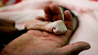 يمني يمسك بيد ابنته التي ماتت بسبب سوء التغذية في اليمن