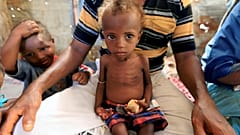 A malnourished girl sits on her father's lap in Hodeidah, Yemen