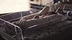 Γεννήθηκε το πρώτο μωρό με ρομποτικά υποβοηθούμενη μεταμόσχευση μήτρας