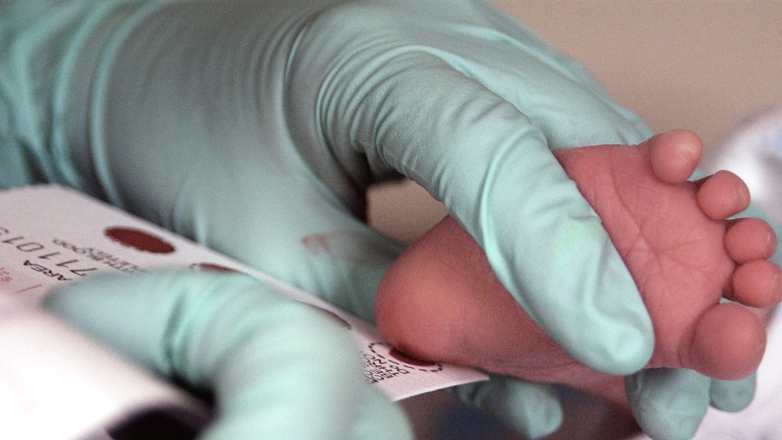 Blood is collected from a newborn for screening.