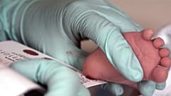 Blood is collected from a newborn for screening.