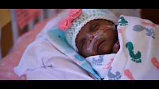Groß wie ein Apfel, 245 gr leicht: Baby gewinnt Kampf ums Überleben