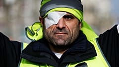 راهپیمایی جلیقه‌زردهای یک چشم و یک دست در فرانسه