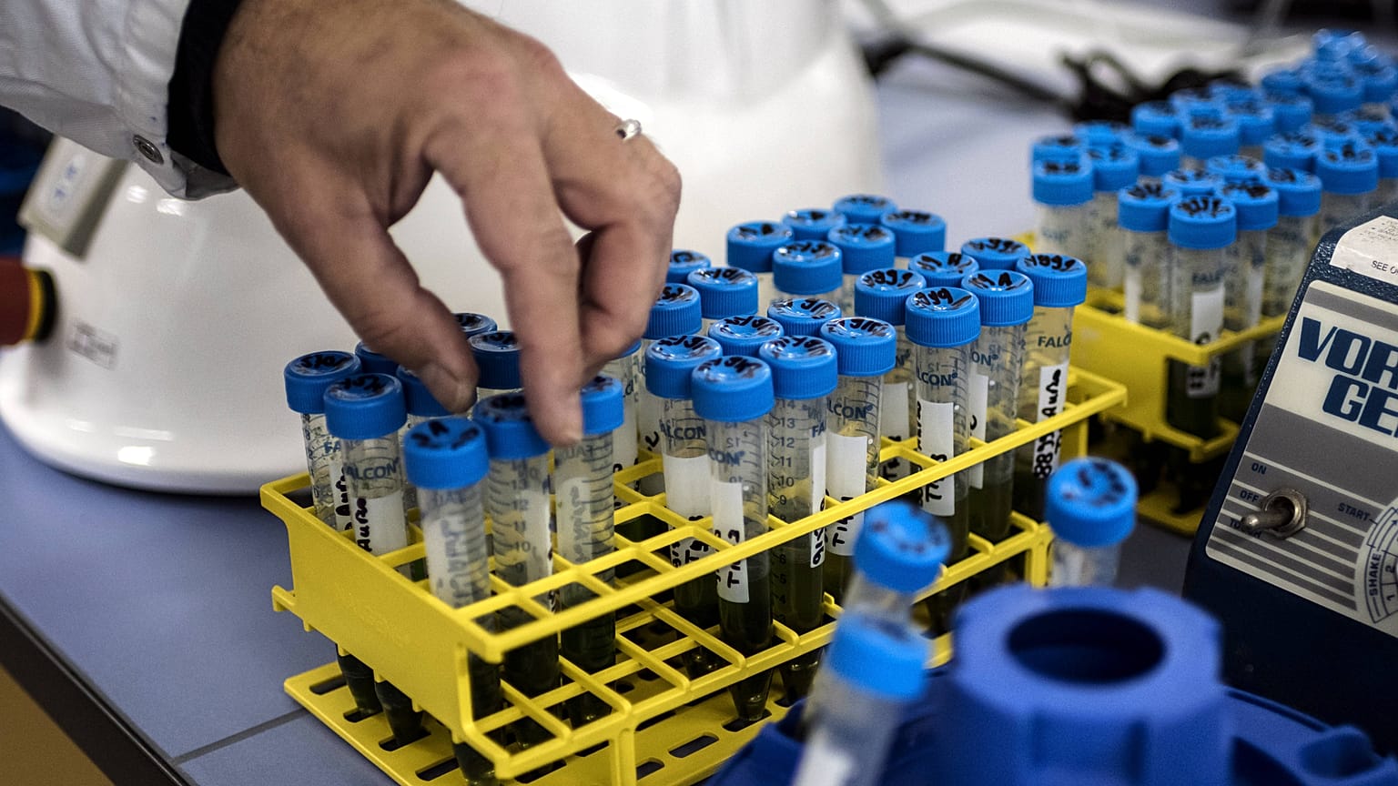 Fight against HIV: What is CRISPR-Cas9? | Euronews Answers