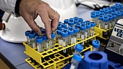 Fight against HIV: What is CRISPR-Cas9? | Euronews Answers