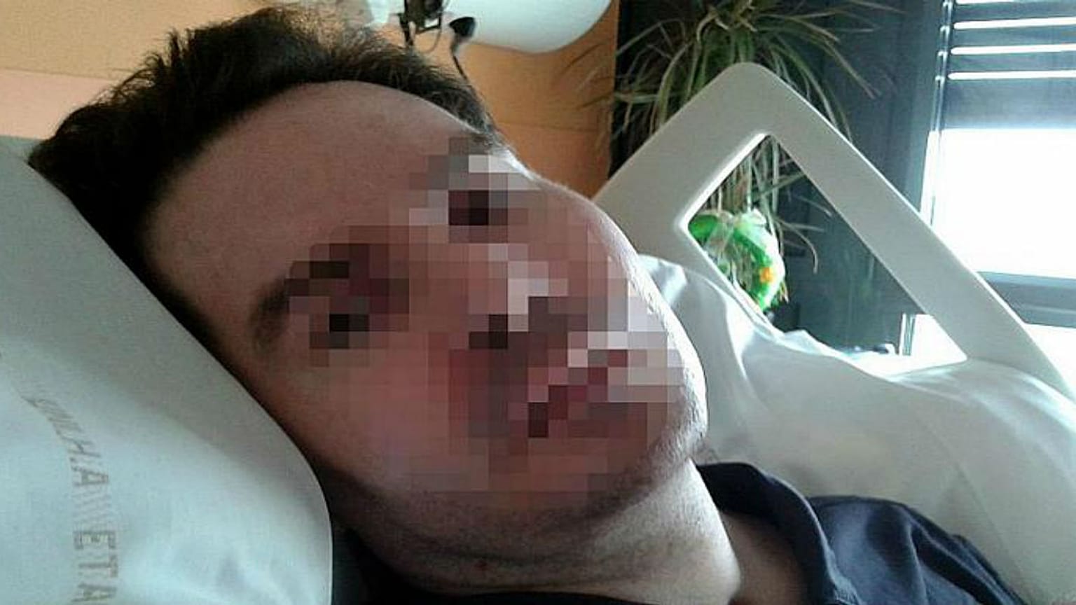 وفاة الفرنسي فانسان لامبرت إثر فصل أجهزة الإنعاش عنه بعد عقد من الزمن