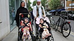 Yapışık ikizler 55 saatlik ameliyatla ayrıldı