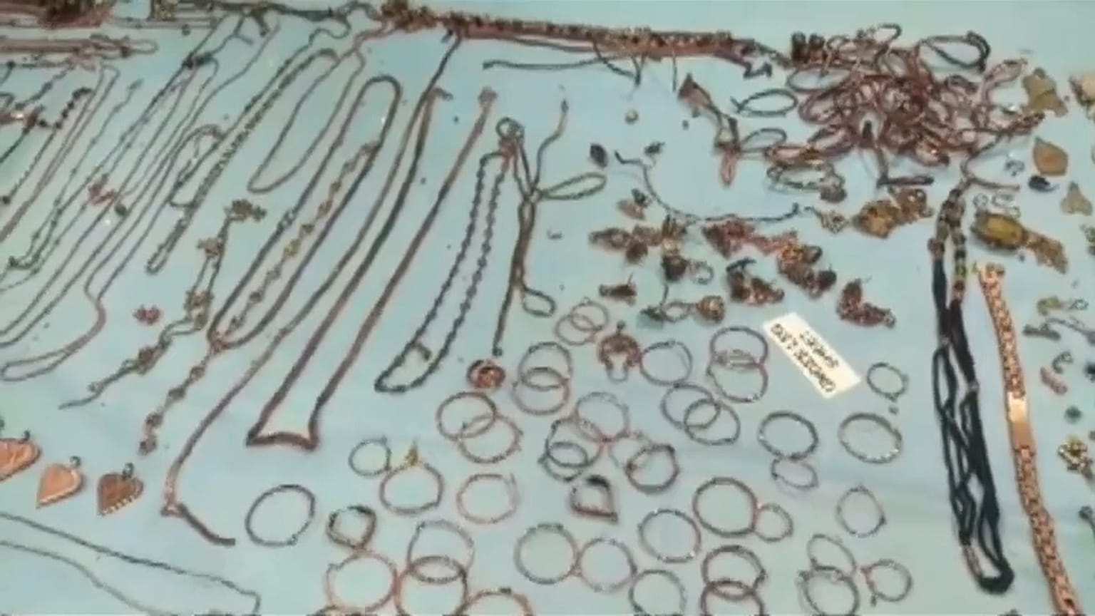 جانب من بعض الحليّ التي وجدها الأطباء في بطن سيدة هندية 