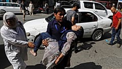 Saldırıda yaralanan kadını hastaneye götürmeye çalışan bir adam / Kabil 