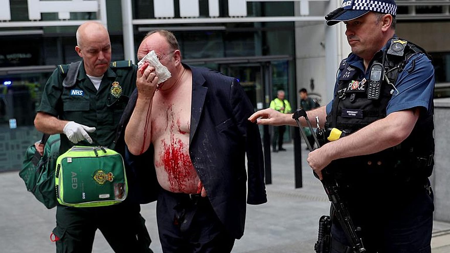 Dem verletzten Mann wird von Ärzten beim Innenministerium in London geholfen