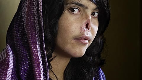 World Press Photo, solo 4 donne vincitrici in 64 anni: "Una professione dominata da uomini"