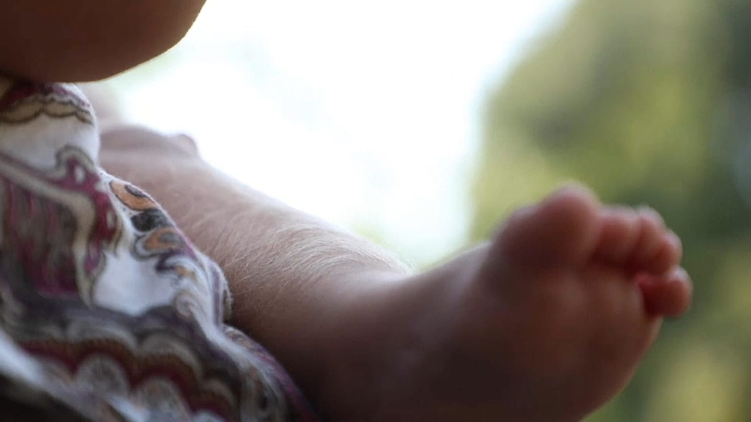 Spagna: bimbi con la "sindrome da lupo mannaro", per scambio di sostanze