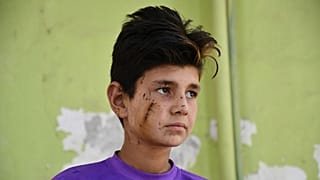 تمیم، پسربچه ۱۲ ساله از باشندگان پلخمری افغانستان که بر اثر انفجار مجروح شد