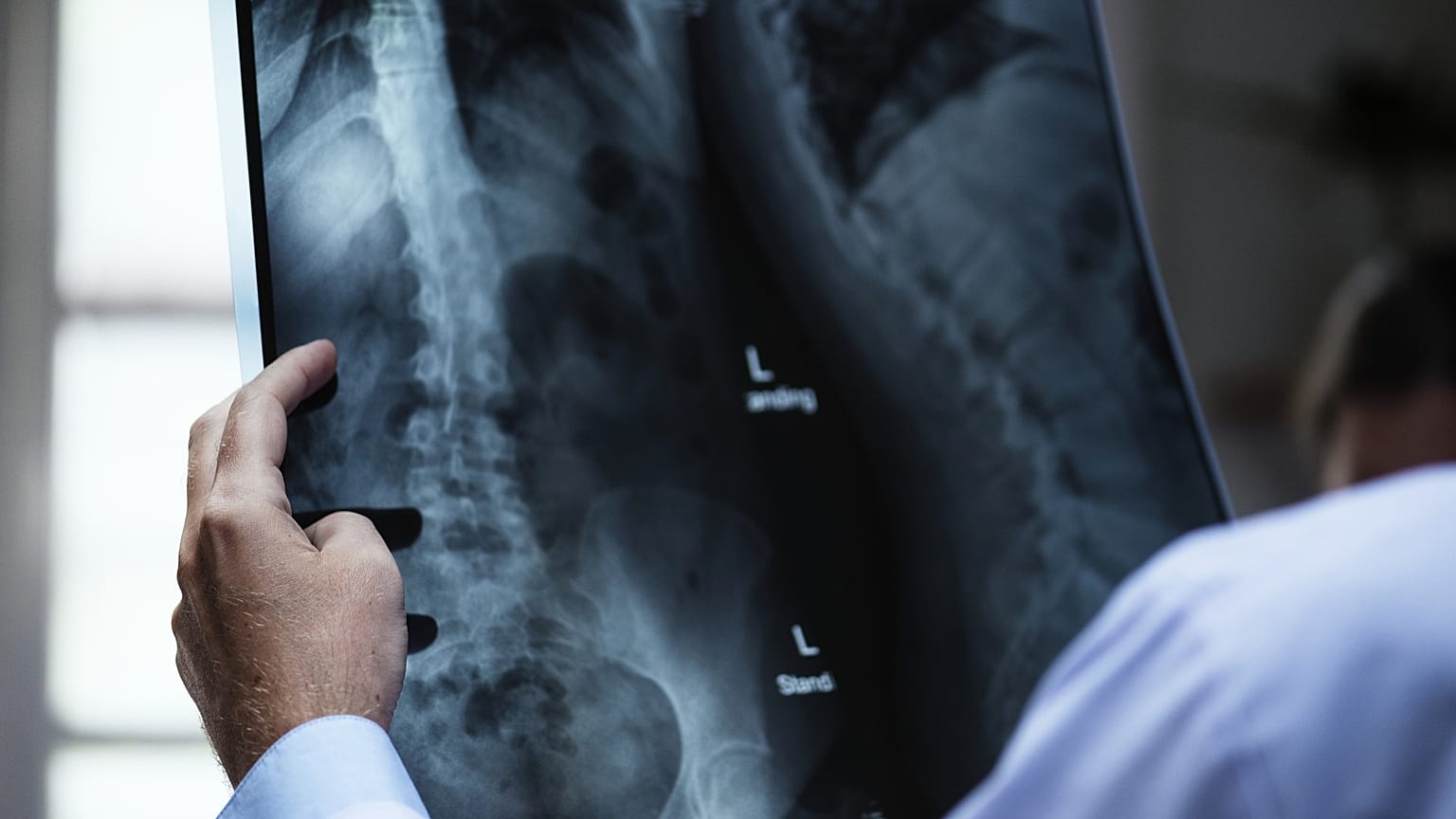 ‘An open door’: Millions of health records ‘unprotected online’
