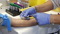 Eczaneden ağrı kesici aldı; kanı maviye dönüştü