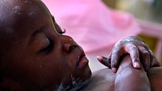 HIV-fertőzött csecsemő alszik az ugandai főváros, Kampala egyik kórházában 2007. november 26-án